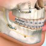 cirugia-oral-y-maxilofacial-2